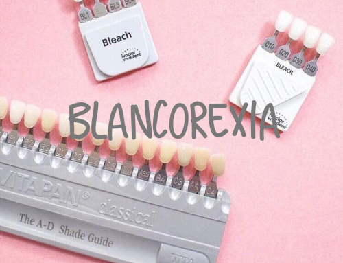 BLANCOREXIA: OBSESIÓN POR TENER LOS DIENTES BLANCOS