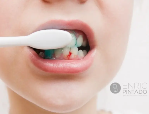 Por qué sangran las encías: causas reales y cuándo preocuparse