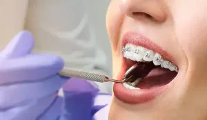 Tratamientos de ortodoncia en Barcelona y Manresa. Enric Pintado