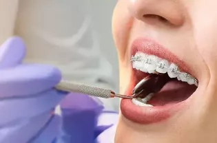 ortodoncia-enric-pintado