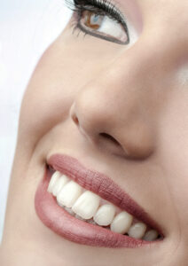 estetica-dental-carillas ortodoncia para adultos en Barcelona y Manresa