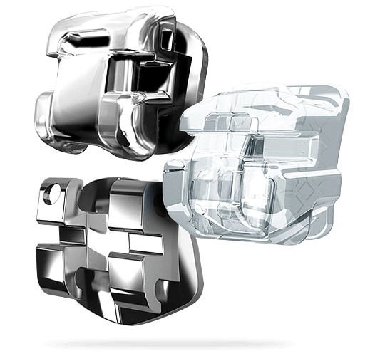 Ortodoncia con brackets en Barcelona y Manresa. Tipos de brackets
