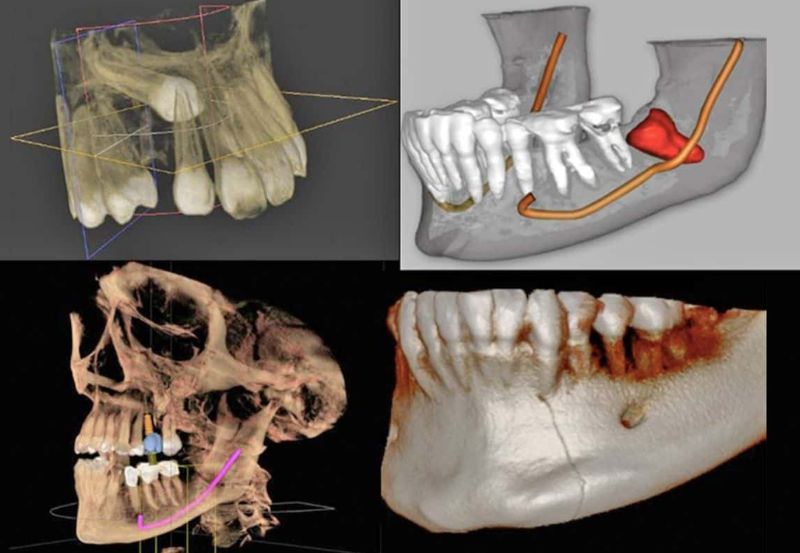 Diagnóstico 3D con mínima radiación