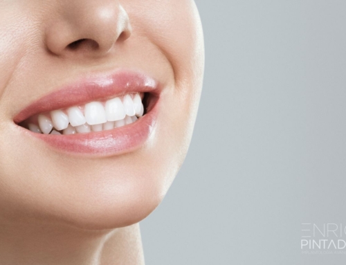 Tratamiento de la Sonrisa Gingival: Guía Completa para una Sonrisa Armoniosa